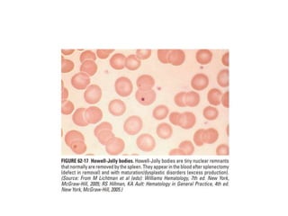 interpreting peripheral blood smears.pptx