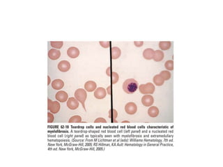 interpreting peripheral blood smears.pptx
