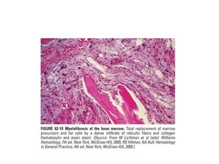 interpreting peripheral blood smears.pptx
