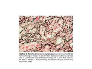 interpreting peripheral blood smears.pptx