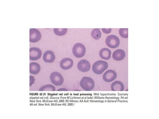 interpreting peripheral blood smears.pptx