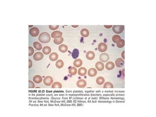 interpreting peripheral blood smears.pptx