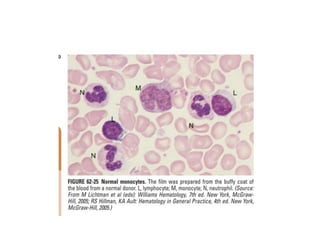 interpreting peripheral blood smears.pptx