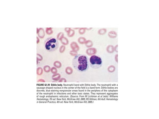 interpreting peripheral blood smears.pptx