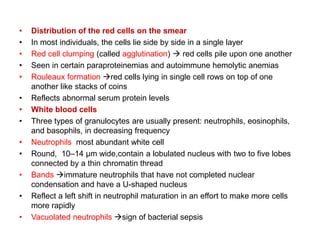 • Distribution of the red cells on the smear
• In most individuals, the cells lie side by side in a single layer
• Red cell clumping (called agglutination)  red cells pile upon one another
• Seen in certain paraproteinemias and autoimmune hemolytic anemias
• Rouleaux formation red cells lying in single cell rows on top of one
another like stacks of coins
• Reflects abnormal serum protein levels
• White blood cells
• Three types of granulocytes are usually present: neutrophils, eosinophils,
and basophils, in decreasing frequency
• Neutrophils most abundant white cell
• Round, 10–14 μm wide,contain a lobulated nucleus with two to five lobes
connected by a thin chromatin thread
• Bands immature neutrophils that have not completed nuclear
condensation and have a U-shaped nucleus
• Reflect a left shift in neutrophil maturation in an effort to make more cells
more rapidly
• Vacuolated neutrophils sign of bacterial sepsis
 
