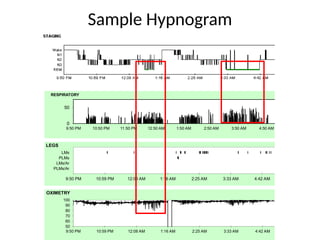 interpreting Sleep Studies primer (1).pptx