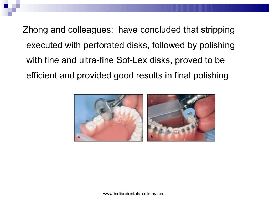 Interproximal enamel reduction