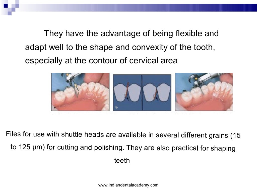 Interproximal enamel reduction