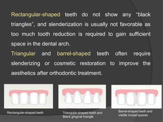 Rectangular-shaped teeth do not show any “black
triangles”, and slenderization is usually not favorable as
too much tooth reduction is required to gain sufficient
space in the dental arch.
Triangular and barrel-shaped teeth often require
slenderizing or cosmetic restoration to improve the
aesthetics after orthodontic treatment.
Barrel-shaped teeth and
visible incisal spaces
Triangular-shaped teeth and
Black gingival triangle
Rectangular-shaped teeth
 