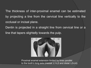 The thickness of inter-proximal enamel can be estimated
by projecting a line from the cervical line vertically to the
occlusal or incisal plane.
Dentin is projected in a straight line from cervical line or a
line that tapers slightelly towards the pulp.
Proximal enamel extension limited by lines parallel
to the tooth’s long axis (mesial: L1-L2 and distal: L3-L4).
 