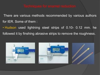 Techniques for enamel reduction
There are various methods recommended by various authors
for IER. Some of them :
• Hudson used lightning steel strips of 0.10- 0.12 mm. he
followed it by finshing abrasive strips to remove the roughness.
 