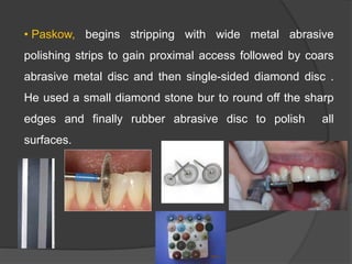 • Paskow, begins stripping with wide metal abrasive
polishing strips to gain proximal access followed by coars
abrasive metal disc and then single-sided diamond disc .
He used a small diamond stone bur to round off the sharp
edges and finally rubber abrasive disc to polish all
surfaces.
 