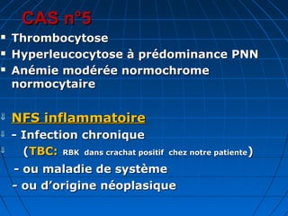 CAS n°5CAS n°5
 ThrombocytoseThrombocytose
 Hyperleucocytose à prédominance PNNHyperleucocytose à prédominance PNN
 Anémie modérée normochromeAnémie modérée normochrome
normocytairenormocytaire
⇓ NFS inflammatoireNFS inflammatoire
⇓ - Infection chronique- Infection chronique
⇓ ((TBC:TBC: RBK dans crachat positif chez notre patienteRBK dans crachat positif chez notre patiente))
- ou maladie de système- ou maladie de système
- ou d’origine néoplasique- ou d’origine néoplasique
 