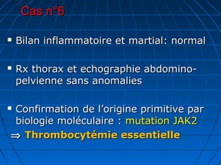 Cas n°6Cas n°6
 Bilan inflammatoire et martial: normalBilan inflammatoire et martial: normal
 Rx thorax et echographie abdomino-Rx thorax et echographie abdomino-
pelvienne sans anomaliespelvienne sans anomalies
 Confirmation de l’origine primitive parConfirmation de l’origine primitive par
biologie moléculaire :biologie moléculaire : mutation JAK2mutation JAK2
⇒⇒ Thrombocytémie essentielleThrombocytémie essentielle
 