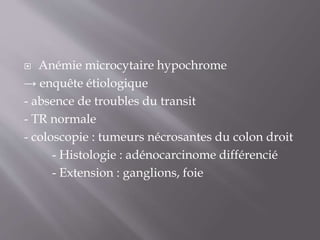  Anémie microcytaire hypochrome
→ enquête étiologique
- absence de troubles du transit
- TR normale
- coloscopie : tumeurs nécrosantes du colon droit
- Histologie : adénocarcinome différencié
- Extension : ganglions, foie
 