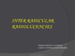 INTER RADICULAR
RADIOLUCENCIES
INDIAN DENTAL ACADEMY
Leader in continuing Dental Education
www.indiandentalacademy.com
 