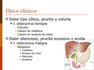 Datos clínicos Dolor tipo cólico, prurito y coluria I. obstructiva benigna Cálculos Litiasis de colédoco Litiasis en ampula de Vater Dolor silencioso, prurito excesivo y acolia I. obstructiva maligna Neoplasia Colédoco Ampula de vater Páncreas duodeno 