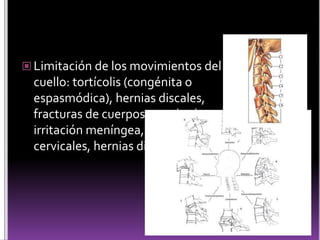  Limitación de los movimientos del
cuello: tortícolis (congénita o
espasmódica), hernias discales,
fracturas de cuerpos vertebrales,
irritación meníngea, costillas
cervicales, hernias discales.
 