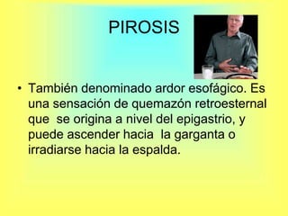 PIROSISTambién denominado ardor esofágico. Es una sensación de quemazón retroesternal que  se origina a nivel del epigastrio, y puede ascender hacia  la garganta o irradiarse hacia la espalda.
