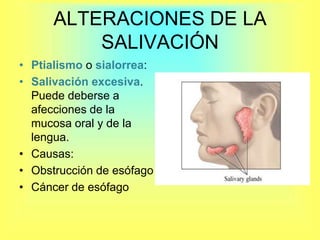ALTERACIONES DE LA SALIVACIÓNPtialismo o sialorrea:Salivación excesiva. Puede deberse a afecciones de la mucosa oral y de la lengua. Causas:Obstrucción de esófagoCáncer de esófago