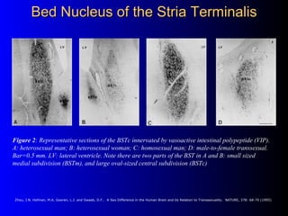 Bed Nucleus of the Stria Terminalis




Figure 2: Representative sections of the BSTc innervated by vasoactive intestinal ...