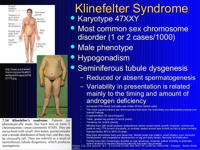 Intersex People Who Are They