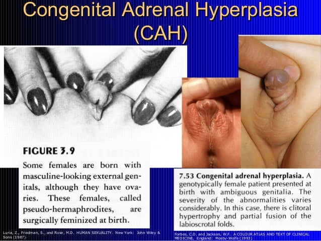 INTERSEX PEOPLE - Who Are They? INTERSEX PEOPLE - Who Are They?