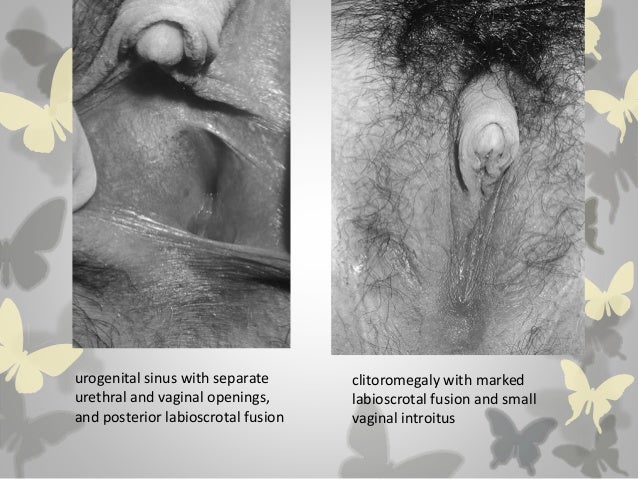 Intersex Presentation