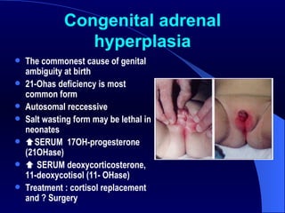 Congenital adrenal hyperplasia The commonest cause of genital ambiguity at birth 21-Ohas deficiency is most common form Autosomal reccessive Salt wasting form may be lethal in neonates  SERUM  17OH-progesterone  (21OHase)    SERUM deoxycorticosterone, 11-deoxycotisol (11- OHase) Treatment : cortisol replacement and ? Surgery 