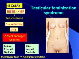 Testicular feminization syndrome 46-XY/SRY  TESTIS    MIF Testosterone  5-  -reductase DHT  Absent androgen receptors  Male Internal Genitalia   Female External Genitalia   Incomplete form    Ambigious genitalia  