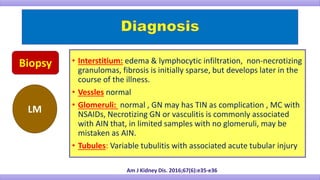 Biopsy
LM
• Interstitium: edema & lymphocytic infiltration, non-necrotizing
granulomas, fibrosis is initially sparse, but develops later in the
course of the illness.
• Vessles normal
• Glomeruli: normal , GN may has TIN as complication , MC with
NSAIDs, Necrotizing GN or vasculitis is commonly associated
with AIN that, in limited samples with no glomeruli, may be
mistaken as AIN.
• Tubules: Variable tubulitis with associated acute tubular injury
Am J Kidney Dis. 2016;67(6):e35-e36
 