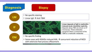 Biopsy
LM
IF
• No specific staining
• Linear IgG  Anti TBM
Linear deposits of IgG in methicillin-
induced acute interstitial nephritis.
Deposits along TBM are shown on IF
microscopy. These antibodies
recognize either a component of the
TBM or a methicillin metabolite
(dimethoxyphenylpenicilloyl) bound to
the TBM. (Courtesy Dr. B Mougenot,
Paris VI University, Paris.)
EM • No specific finding
• Some cases with NSAIDs-induced AIN,  concurrent induction of MCD
with extensive foot process effacement.
 