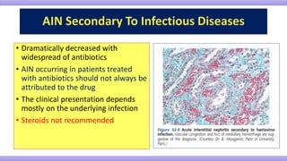 • Dramatically decreased with
widespread of antibiotics
• AIN occurring in patients treated
with antibiotics should not always be
attributed to the drug
• The clinical presentation depends
mostly on the underlying infection
• Steroids not recommended
 