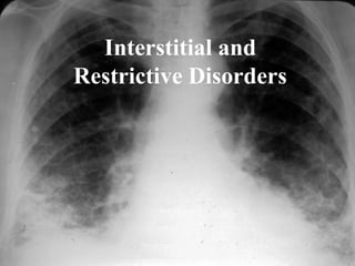 Interstitial and
Restrictive Disorders
 