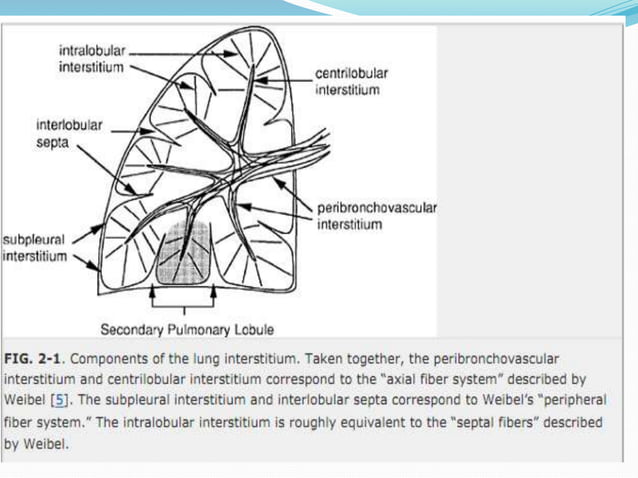 Interstitial lung-diseases | PPT