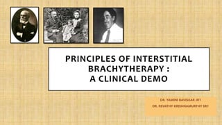 PRINCIPLES OF INTERSTITIAL
BRACHYTHERAPY :
A CLINICAL DEMO
DR. YAMINI BAVISKAR JR1
DR. REVATHY KRISHNAMURTHY SR1
 