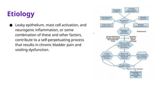 Etiology
● Leaky epithelium, mast cell activation, and
neurogenic inflammation, or some
combination of these and other factors,
contribute to a self-perpetuating process
that results in chronic bladder pain and
voiding dysfunction.
 