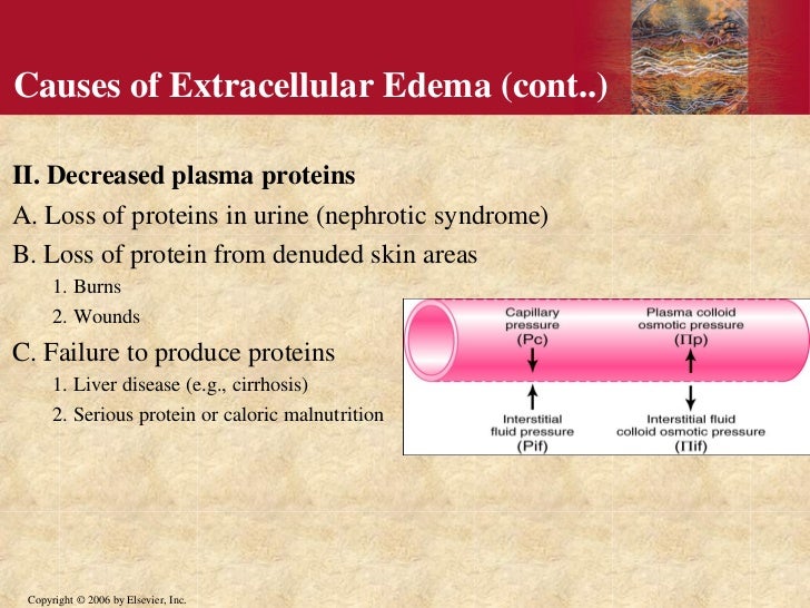 Interstitial fluid formation and edema by dr. mudassar ali roomi