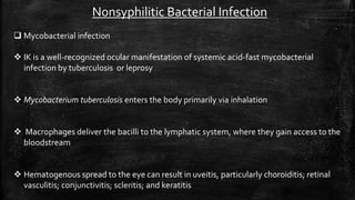 Nonsyphilitic Bacterial Infection
 Mycobacterial infection
 IK is a well-recognized ocular manifestation of systemic acid-fast mycobacterial
infection by tuberculosis or leprosy
 Mycobacterium tuberculosis enters the body primarily via inhalation
 Macrophages deliver the bacilli to the lymphatic system, where they gain access to the
bloodstream
 Hematogenous spread to the eye can result in uveitis, particularly choroiditis; retinal
vasculitis; conjunctivitis; scleritis; and keratitis
 