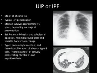 UIP or IPF MC of all chronic ILD  Typical  c/f presentation Median survival approximately 3 years, depending on stage at presentation.  B/L Reticular bibasilar and subpleural opacities. minimal ground-glass and variable honeycomb change.  Type I pneumocytes are lost, and there is proliferation of alveolar type II cells. "Fibroblast foci" of actively proliferating fibroblasts and myofibroblasts.  