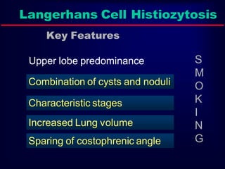Langerhans Cell Histiozytosis
Key Features
Upper lobe predominance

Combination of cysts and noduli
Characteristic stages
Increased Lung volume
Sparing of costophrenic angle

S
M
O
K
I
N
G

 