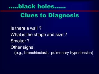 …..black holes……

Clues to Diagnosis
Is there a wall ?
What is the shape and size ?
Smoker ?
Other signs
(e.g., bronchiectasis, pulmonary hypertension)

 