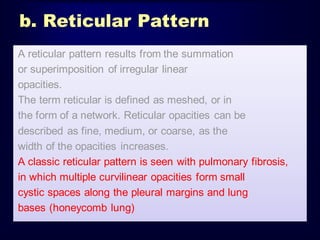 b. Reticular Pattern
A reticular pattern results from the summation
or superimposition of irregular linear
opacities.
The term reticular is defined as meshed, or in
the form of a network. Reticular opacities can be
described as fine, medium, or coarse, as the
width of the opacities increases.
A classic reticular pattern is seen with pulmonary fibrosis,
in which multiple curvilinear opacities form small
cystic spaces along the pleural margins and lung
bases (honeycomb lung)

 