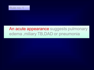 Rule no. 1

An acute appearance suggests pulmonary
edema ,miliary TB,DAD or pneumonia

 