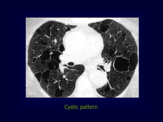 Cystic pattern

 