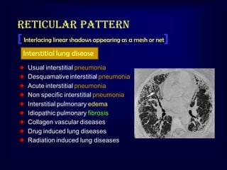 Reticular pattern
[ Interlacing linear shadows appearing as a mesh or net]
Interstitial lung disease
Usual interstitial pneumonia
Desquamative interstitial pneumonia
Acute interstitial pneumonia
Non specific interstitial pneumonia
Interstitial pulmonary edema
Idiopathic pulmonary fibrosis
Collagen vascular diseases
Drug induced lung diseases
Radiation induced lung diseases

 