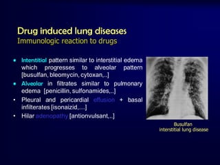 Drug induced lung diseases
Immunologic reaction to drugs
• Interstitial pattern similar to interstitial edema
which progresses to alveolar pattern
[busulfan, bleomycin, cytoxan,..]
• Alveolar in filtrates similar to pulmonary
edema [penicillin, sulfonamides,..]
• Pleural and pericardial effusion + basal
infilterates [isonaizid,…]
• Hilar adenopathy [antionvulsant,..]
Busulfan
interstitial lung disease

 