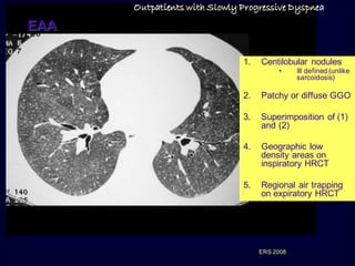 Outpatients with Slowly Progressive Dyspnea

EAA
1.

Centilobular nodules
•

Ill defined (unlike
sarcoidosis)

2.

Patchy or diffuse GGO

3.

Superimposition of (1)
and (2)

4.

Geographic low
density areas on
inspiratory HRCT

5.

Regional air trapping
on expiratory HRCT

ERS 2008

 