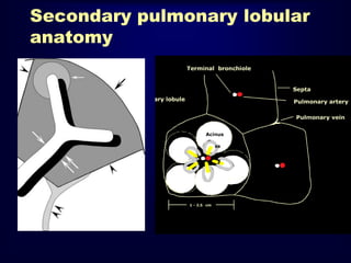 Secondary pulmonary lobular
anatomy

 