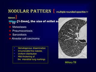 Nodular pattern [ multiple rounded opacities 110mm]
Miliary [1-2mm], the size of millet seeds
TB
Metastases
Pneumoconiosis
Sarcoidosis
Alveolar cell carcinoma






Hematogenous dissemination
Innumerable fine nodules
Uniform distribution
Mild thickening of
the interstitial lung markings

Miliary TB

 
